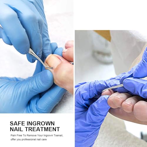 Ingrown Toenail File and Lifter Tool Kit - Stainless Steel Pedicure Set