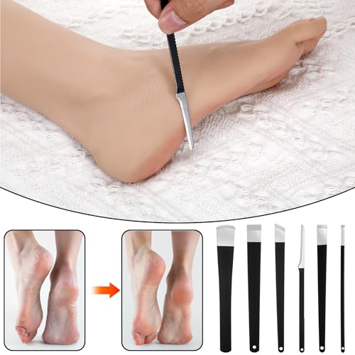 Gtziqa 6-Piece Stainless Steel Ingrown Toenail Removal Kit & Pedicure Tool Set
