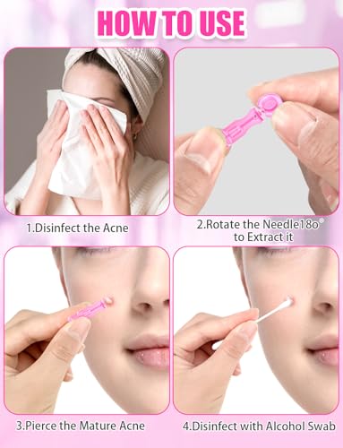 Disposable Facial Extraction Lancets 50Pcs Pink Acne Needle Tools