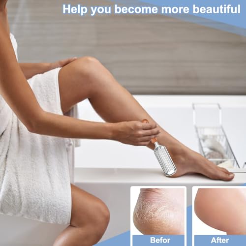 Untrytb Professional Foot File and Callus Remover for Cracked Heels