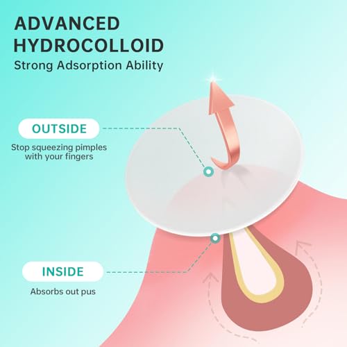 Aquuaera Hydrocolloid Pimple Patches 210 Count - Acne Spot Care