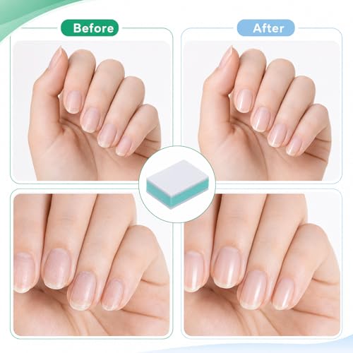 Zelphvt 30 Pack Mini Nail Buffer Blocks and Shine Kit for Natural Nails