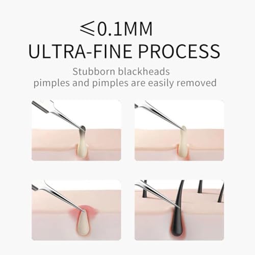 Jizlan 3-Piece Professional Blackhead Removal Tweezer Set Stainless Steel