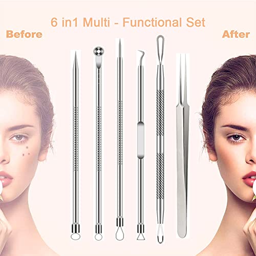BLAAROOM 6-Piece Pimple Popper Tool Kit - Stainless Steel Blackhead Remover Set