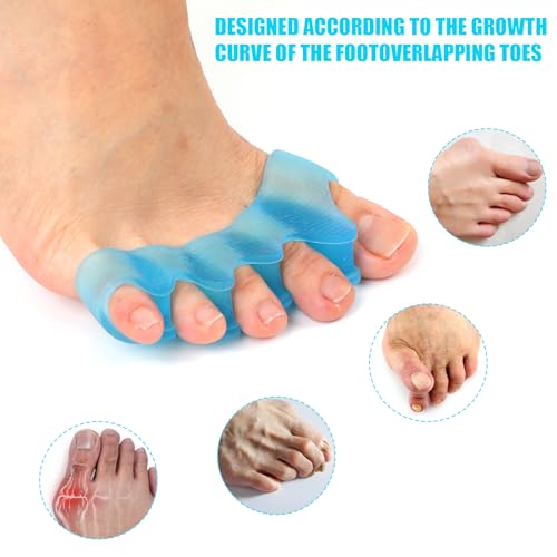Gosknor Silicone Toe Separators for Pedicure and Toe Correction (2 Pack)