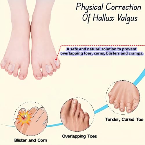 Gel Toe Separators 6 Pack - Soft Silicone Spacers for Bunion Relief