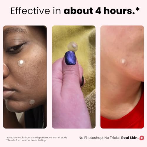 ROSELYNBOUTIQUE Hydrocolloid Pimple Patches - 60ct Acne Spot Treatment