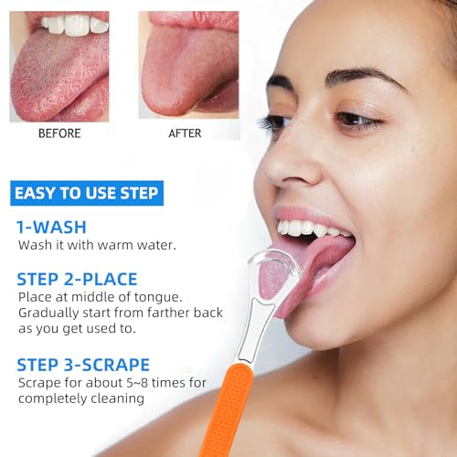 Stainless Steel Tongue Scraper 2-Pack with Silicone Handle for Bad Breath
