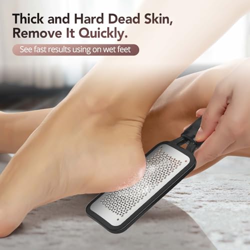 Kolavia 2 Pack Foot File Callus Remover - Stainless Steel Double-Sided Foot Scrubber