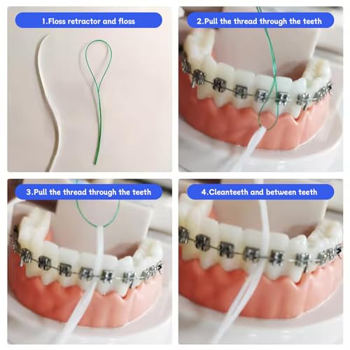 Ceonam 70 Count Dental Floss Threaders for Braces, Bridges and Implants