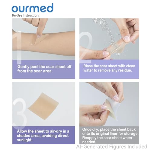 ourmed Medical Grade Silicone Scar Removal Sheets, 1.6" x 6", 5 Pack