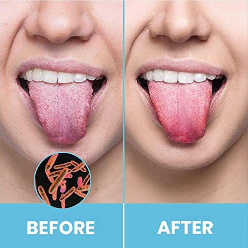 HOKIN Stainless Steel Tongue Scraper - 2Pack Oral Care & Bad Breath Solution