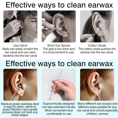 Zoolinn Stainless Steel Tonsil Stone Remover and Ear Wax Removal Tool Set