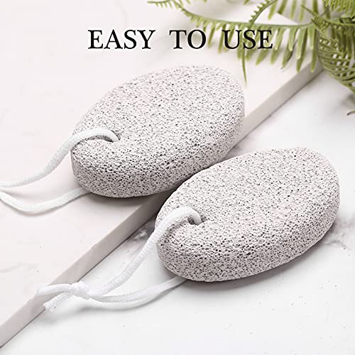 HOOMBOOM Natural Pumice Stone for Feet (2-Pack) - Hard Skin and Callus Remover