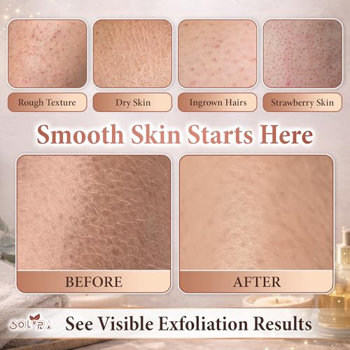 Solvra Exfoliating Body Scrubber - Vegan Viscose Kessa Mitt for Dead Skin