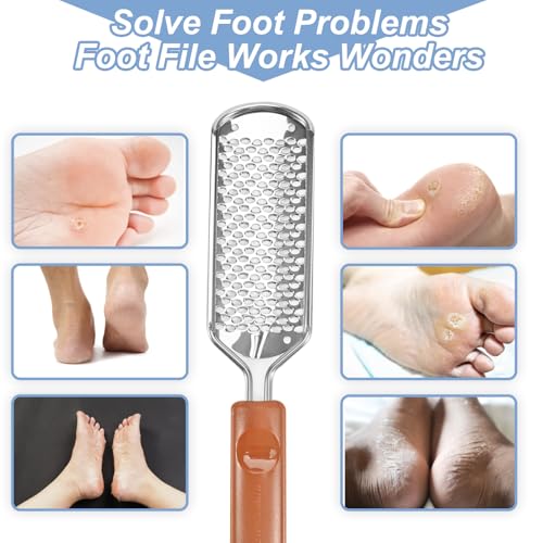 Untrytb Professional Foot File and Callus Remover for Cracked Heels