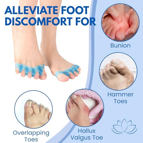 Shimsol Soft Silicone Toe Spacers for Bunion Relief and Pedicure