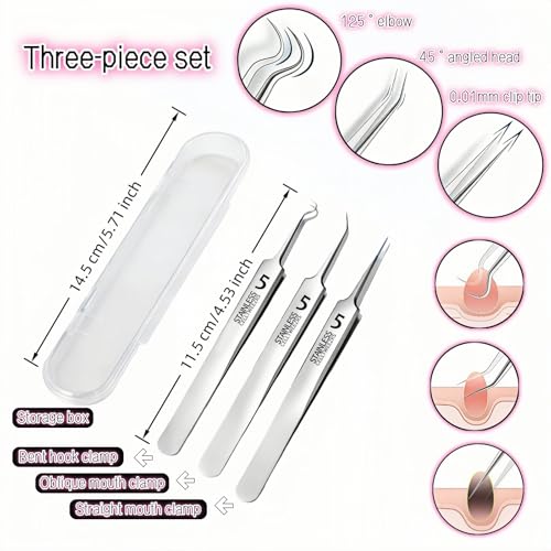 Blackhead Remover Tweezers Set, Stainless Steel Pimple Extractor Tool Kit with Storage Case