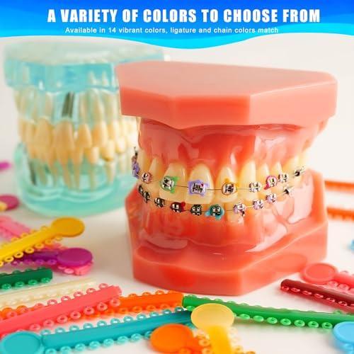 Orthodontic Ligature Ties 1040pcs - Multi-Color Elastomeric O-Rings