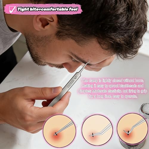 Blackhead Remover Tweezers Set, Stainless Steel Pimple Extractor Tool Kit with Storage Case