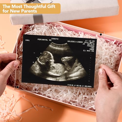 6x8 Magnetic Acrylic Ultrasound Picture Frame - Rectangle Sonogram Keepsake