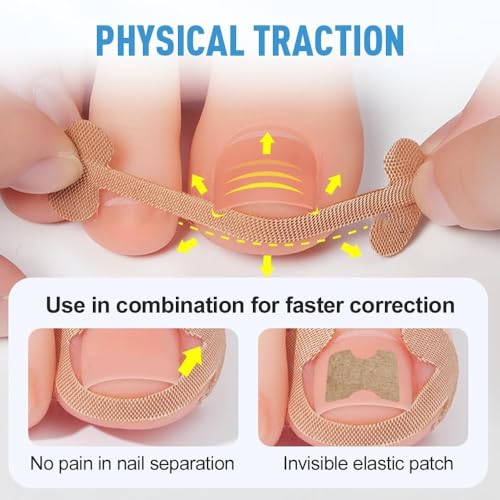 Ingrown Toenail Removal Kit with Correction Patches and Stainless Steel Tools