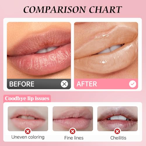 Hxssll Moisturizing Lip Balm with Vitamin E and Shea Butter for Dry Lips