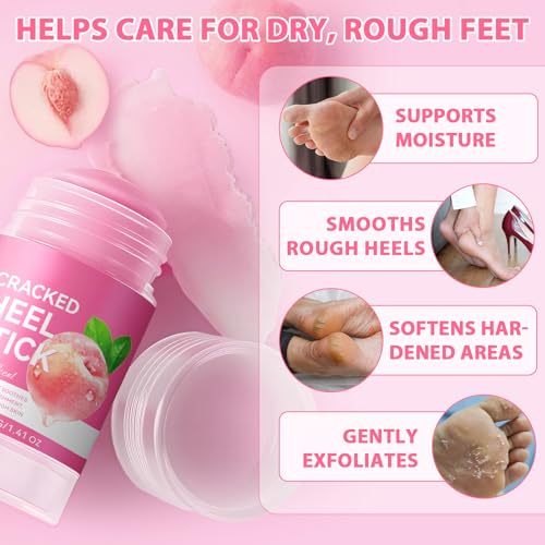 Urea Cream Foot Callus Remover Stick - 60% Urea & 2% Salicylic Acid