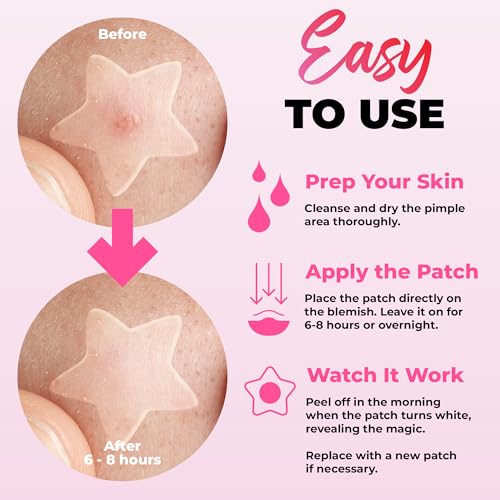 Andlane Cute Pimple Patches - 260 Pcs Hydrocolloid Acne Zit Stickers
