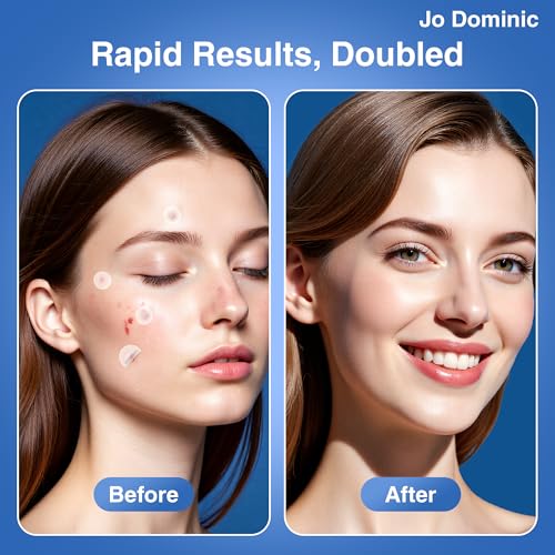 Jo Dominic Invisible Hydrocolloid Pimple Patches 255 Count
