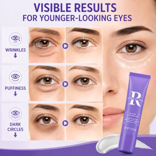 ROUXUN Retinol Eye Cream - Anti-Aging Moisturizing Eye Care with Hyaluronic Acid 0.7 oz
