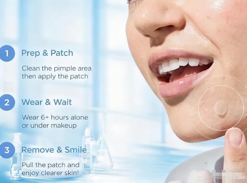 Pimple Patches 300 Count - Acne Spot Stickers for Face and Blemishes
