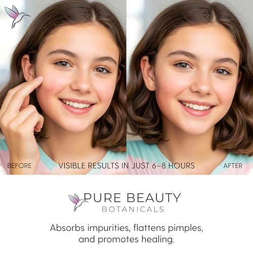 Pure Beauty Botanicals Hydrocolloid Acne Patches for Blemishes