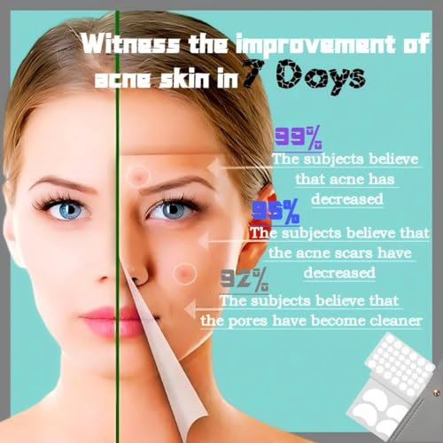 Guiyal Hydrocolloid Acne Patches with Essential Oils - 112 Pcs