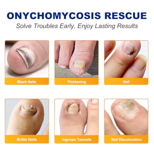 Ruduwu Extra Strength Toenail Treatment Patches - 32 Overnight Nail Repair Strips