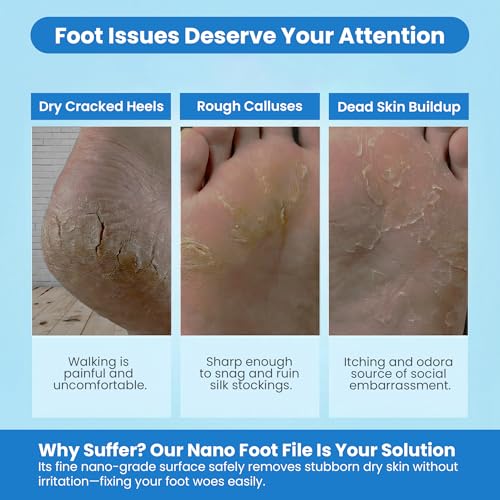 KPEBN Nano Glass Foot File & Callus Remover for Cracked Heels