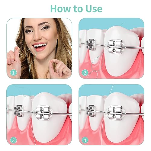 WLLHYF 100 Pcs Dental Floss Threaders for Braces, Bridges, and Implants