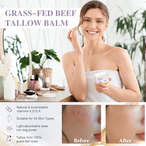 ADOVA Whipped Tallow Balm with Calendula & NAD+ - 2 Pack Face & Body Moisturizer
