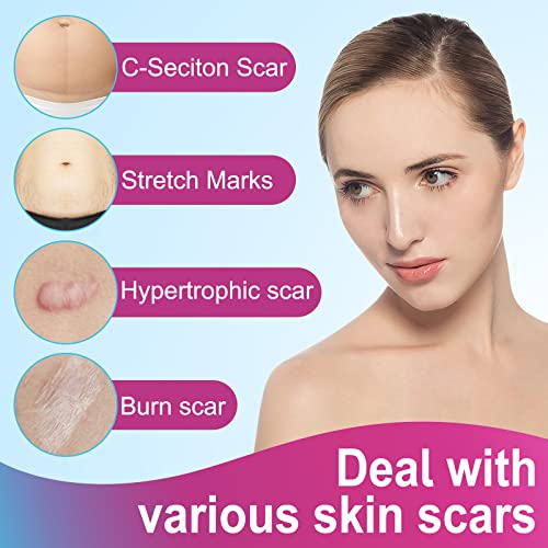 Silicone Scar Tape Roll, 1.6" x 75" Medical Grade Scar Sheets for Old and New Scars