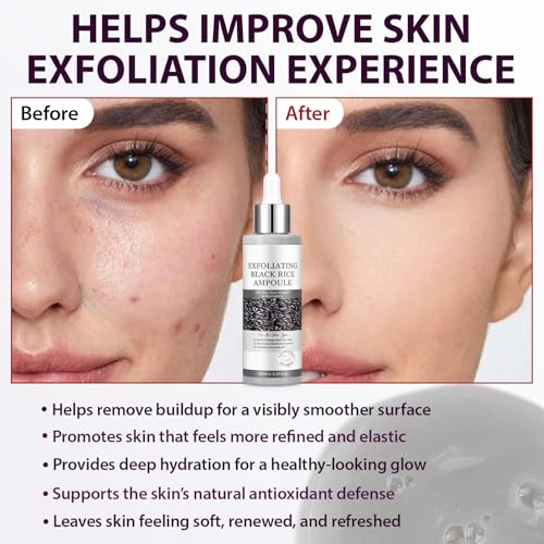 Black Rice Peeling Glow Ampoule 100ml – Gentle Exfoliating Face & Body Serum with Hyaluronic Acid