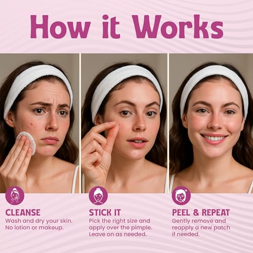 Andlane 344 Pcs Large Hydrocolloid Pimple Patches – 7 Sizes & Shapes for Face and Body