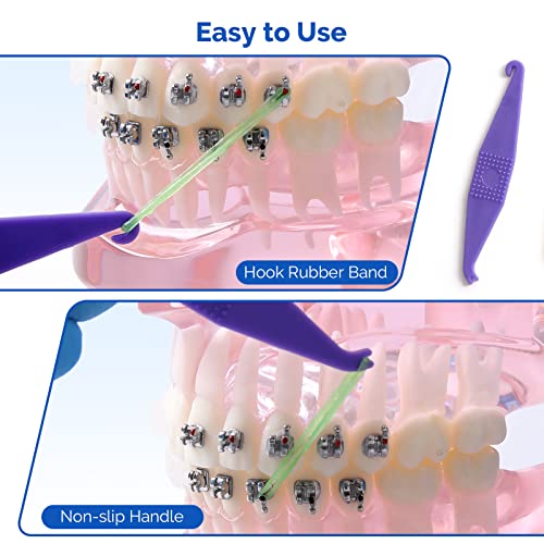 JMU Orthodontic Elastics 3/16 Medium Force 100 Pack Dental Rubber Bands