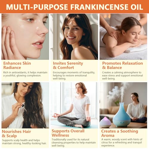 ITSDAWN Frankincense Essential Oil for Face, Hair, and Aromatherapy - 2.02 Fl Oz
