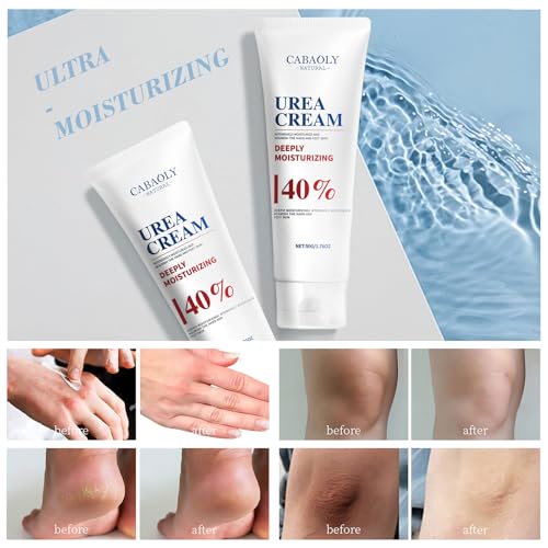 CABAOLY 40% Urea Cream for Dry Cracked Heels, Hands, and Feet
