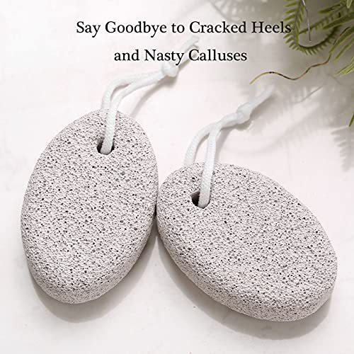 HOOMBOOM Natural Pumice Stone for Feet (2-Pack) - Hard Skin and Callus Remover