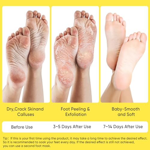 Berlaney Foot Peeling Mask 3 Pairs - Exfoliating Dead Skin Remover