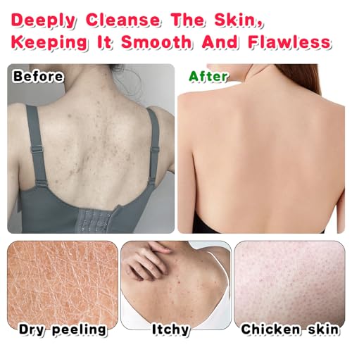 3-Pack Exfoliating Back Scrubber for Shower & Bath Towel