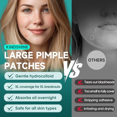 Kindshine Large Hydrocolloid Acne Patches - 20 Pcs Extra Large Pimple Patches for Face & Body