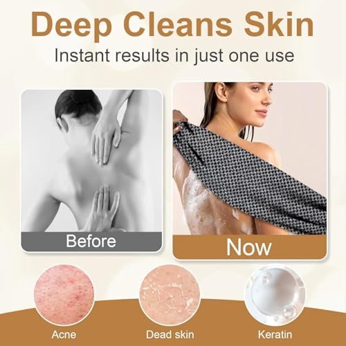 WEAIMYST Dual-Sided Exfoliating Shower Towel - Deep Cleansing Body Scrubber
