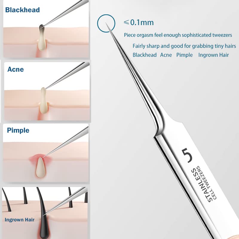 Jedrey Titanium Alloy Blackhead Remover & Pimple Extractor Tools 2-Pack